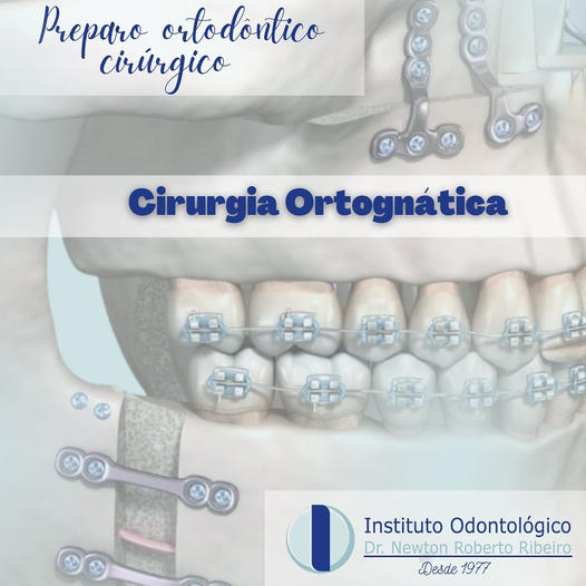 Tratamento ortodôntico para cirurgia ortognática. – Instituto